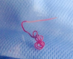 roundworm, parasites in fish in delaware, sussex county, flounder, lewes canal, nematode, 